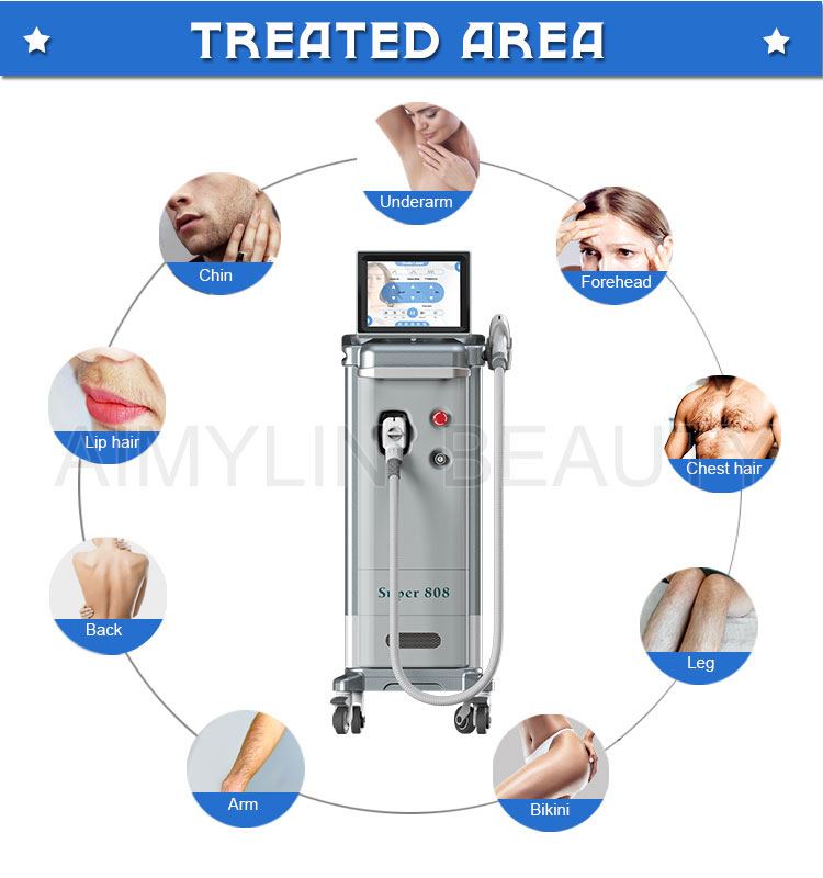 hair removal laser 
